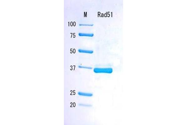 RAD51 Protéine