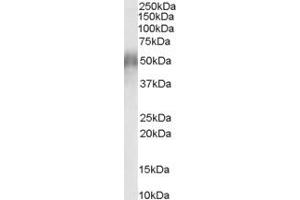 Western Blotting (WB) image for anti-CD2 (Cytoplasmic Tail) Binding Protein 2 (CD2BP2) (N-Term) antibody (ABIN2465515) (CD2BP2 anticorps  (N-Term))