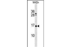 Western blot analysis in WiDr cell line lysates (35ug/lane). (NHLH1 anticorps  (AA 38-67))