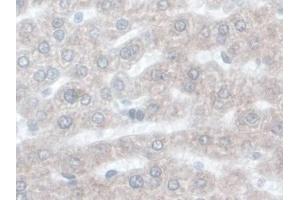 DAB staining on IHC-P; Samples: Rat Liver Tissue) (ORM1 anticorps  (AA 19-186))