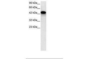 Image no. 2 for anti-Eyes Absent Homolog 3 (EYA3) (AA 277-326) antibody (ABIN6735802) (EYA3 anticorps  (AA 277-326))