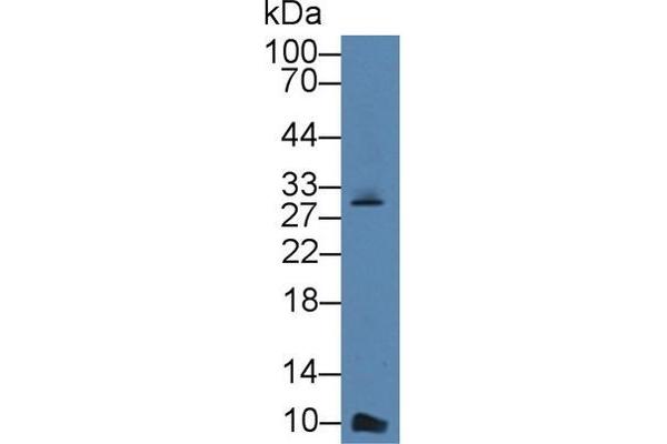 beta-Thromboglobulin anticorps  (AA 40-113)