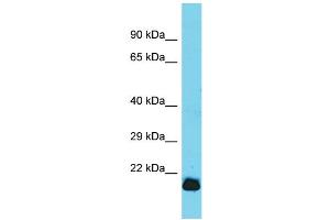 Host: Rabbit  Target Name: Gpx7  Sample Tissue: Rat Heart lysates  Antibody Dilution: 1. (Glutathione Peroxidase 7 anticorps  (C-Term))