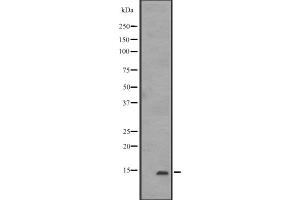 Western blot analysis of IFITM1 expression in K562,The lane on the left is treated with the antigen-specific peptide. (IFITM1 anticorps  (N-Term))