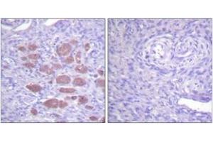 Immunohistochemistry (IHC) image for anti-Neutrophil Cytosolic Factor 4, 40kDa (NCF4) (AA 120-169) antibody (ABIN2888743) (NCF4 anticorps  (AA 120-169))