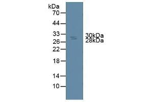 Detection of NME6 in Rat Spleen Tissue using Polyclonal Antibody to Non Metastatic Cells 6, Protein Expressed In (NME6) (Non Metastatic Cells 6, Protein Expressed In (AA 1-173) anticorps)