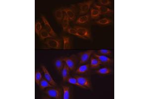Immunofluorescence analysis of U-2 OS cells using HSP27/HSPB1Rabbit mAb (ABIN7267569) at dilution of 1:100 (40x lens). (HSP27 anticorps)