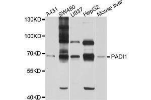Western blot analysis of extracts of various cell lines, using PADI1 antibody (ABIN6003843) at 1/1000 dilution. (PADI1 anticorps)