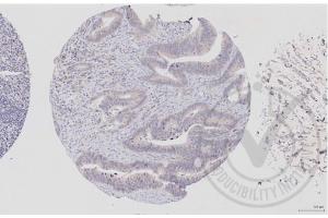 Immunohistochemistry (IHC) image for anti-V-Raf-1 Murine Leukemia Viral Oncogene Homolog 1 (RAF1) (AA 31-130) antibody (ABIN733208)