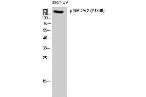 Western Blotting (WB) image for anti-NMDA epsilon 2 (pTyr1336) antibody (ABIN3173327) (NMDA epsilon 2 (pTyr1336) anticorps)