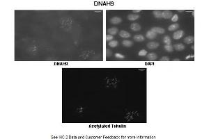 Immunohistochemistry (IHC) image for anti-Dynein, Axonemal, Heavy Chain 9 (DNAH9) (C-Term) antibody (ABIN2790246) (DNAH9 anticorps  (C-Term))