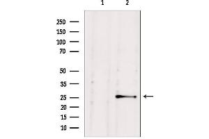 Western blot analysis of extracts from HepG2, using NUDT21 antibody. (NUDT21 anticorps  (Internal Region))