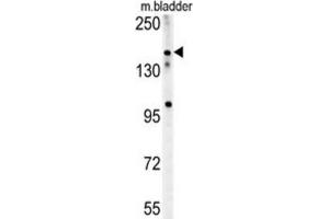 Western Blotting (WB) image for anti-Castor Zinc Finger 1 (CASZ1) antibody (ABIN2995579) (CASZ1 anticorps)