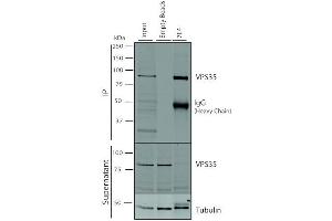 Immunoprecipitation analysis using Mouse Anti-VPS35 Monoclonal Antibody, Clone 7E4 (ABIN6932930). (VPS35 anticorps  (PE))