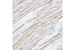 Immunohistochemistry of paraffin-embedded mouse heart using MGLL Rabbit pAb (ABIN6128306, ABIN6143823, ABIN6143824 and ABIN6222352) at dilution of 1:50 (40x lens). (MGLL anticorps  (AA 1-303))