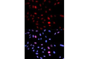 Immunofluorescence analysis of U2OS cells using Phospho-SMC1A-S957 antibody (ABIN5969934). (SMC1A anticorps  (pSer957))