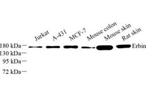 Western blot analysis of Erbin (ABIN7073858) at dilution of 1: 500 (ERBB2IP anticorps)