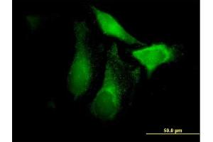 Immunofluorescence of purified MaxPab antibody to CFHR1 on HeLa cell. (CFHR1 anticorps  (AA 1-330))