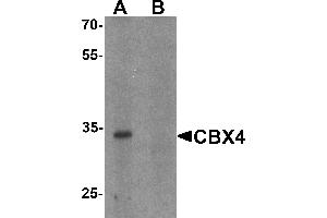 Western blot analysis of CBX4 in human brain tissue lysate with CBX4 antibody at 1 µg/mL in (A) the absence and (B) the presence of blocking peptide. (CBX4 anticorps  (N-Term))