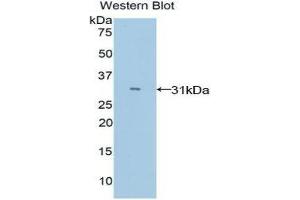 Western Blotting (WB) image for anti-Myosin IE (MYO1E) (AA 772-1033) antibody (ABIN1078394) (MYO1E anticorps  (AA 772-1033))