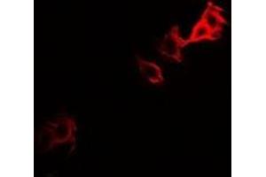 Immunofluorescent analysis of PGM1 staining in U2OS cells. (Phosphoglucomutase 1 anticorps)