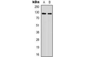 Western blot analysis of XPO1 (AcK568) expression in HepG2 UV-treated (A), mouse brain (B) whole cell lysates. (XPO1 anticorps  (acLys568))