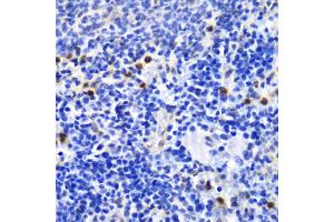 Immunohistochemistry of paraffin-embedded mouse spleen using ANXA1 antibody (ABIN5970468) at dilution of 1/100 (40x lens). (Annexin a1 anticorps)