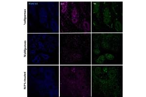 Immunohistochemical detection of progesterone receptor (PR) and estradiol receptor (ER-a) in the basal region of the endometrium in uteri of nulliparous, multiparous and MPA-treated dogs. (Progesterone Receptor anticorps  (AA 501-600) (AbBy Fluor® 488))