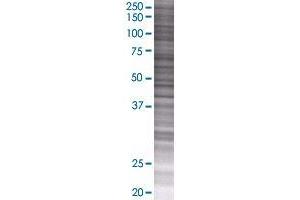 MTFR1 transfected lysate. (MTFR1 293T Cell Transient Overexpression Lysate(Denatured))