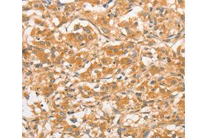 Immunohistochemistry (IHC) image for anti-Toll-Like Receptor 3 (TLR3) antibody (ABIN2422740) (TLR3 anticorps)