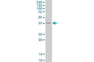 IL12B polyclonal antibody (A01), Lot # 050912JC01. (IL12B anticorps  (AA 229-328))