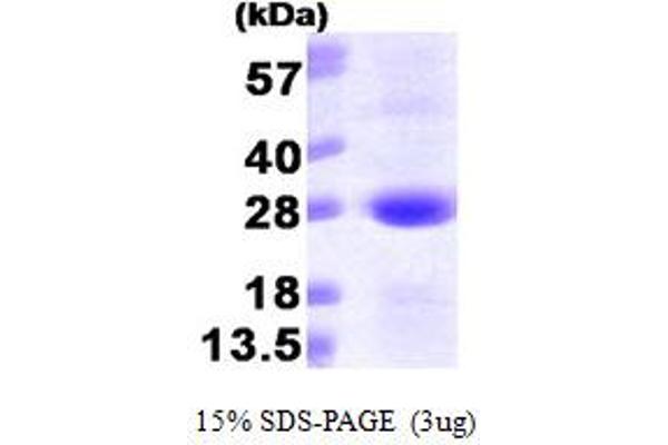 SAR1A Protein (AA 1-198) (His tag)