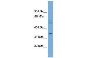 TOMM34 antibody used at 0. (TOMM34 anticorps  (N-Term))