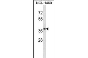 CUTC Antibody (Center) (ABIN1538562 and ABIN2848511) western blot analysis in NCI- cell line lysates (35 μg/lane). (CUTC anticorps  (AA 67-94))