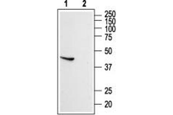 SSTR5 anticorps  (Extracellular, N-Term)
