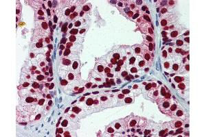 Anti-FOXA1 antibody IHC of human prostate. (FOXA1 anticorps  (AA 367-473))