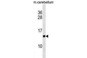 Western Blotting (WB) image for anti-Prefoldin Subunit 2 (PFDN2) antibody (ABIN3001026) (PFDN2 anticorps)