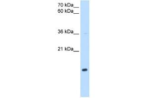 NDUFB5 antibody used at 1 ug/ml to detect target protein. (NDUFB5 anticorps)