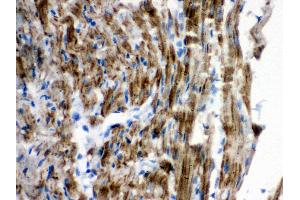 Anti-VDAC Picoband antibody, IHC(P) IHC(P): Rat Cardiac Muscle Tissue (VDAC1 anticorps  (Middle Region))