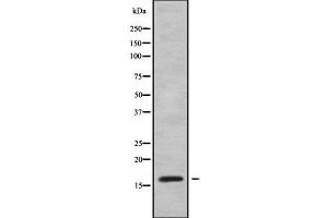 Western blot analysis of VPREB1 using MCF7 whole cell lysates (VPREB1 anticorps  (Internal Region))