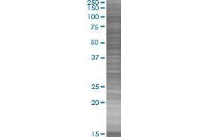 ZCCHC8 transfected lysate. (ZCCHC8 293T Cell Transient Overexpression Lysate(Denatured))