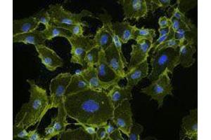 Immunofluorescence (IF) image for Goat anti-Mouse IgG antibody (Alexa Fluor 555) (ABIN2667000) (Chèvre anti-Souris IgG Anticorps (Alexa Fluor 555))
