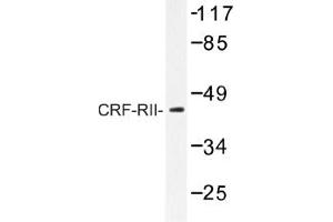 Image no. 1 for anti-Corticotropin Releasing Hormone Receptor 2 (CRHR2) antibody (ABIN317648) (CRHR2 anticorps)