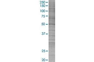 ALDH2 transfected lysate. (ALDH2 293T Cell Transient Overexpression Lysate(Denatured))