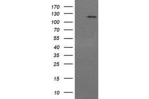 Image no. 6 for anti-PTK2 Protein tyrosine Kinase 2 (PTK2) antibody (ABIN1498193) (FAK anticorps)