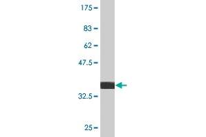 Western Blot detection against Immunogen (36. (SMAD7 anticorps  (AA 160-260))