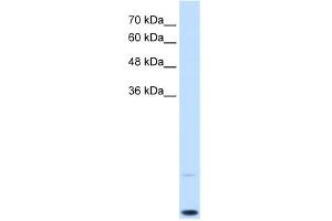WB Suggested Anti-MYC Antibody Titration:  0. (c-MYC anticorps  (C-Term))
