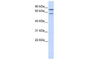 KCNQ1 antibody used at 1 ug/ml to detect target protein. (KCNQ1 anticorps  (N-Term))