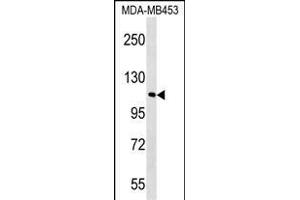 FB Antibody (C-term) (ABIN1537622 and ABIN2848766) western blot analysis in MDA-M cell line lysates (35 μg/lane). (FAM65B anticorps  (C-Term))