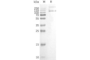 WB analysis of Human T-Nanodisc with anti-Flag monoclonal antibody at 1/5000 dilution, followed by Goat Anti-Rabbit IgG HRP at 1/5000 dilution (TRPV1 Protéine)